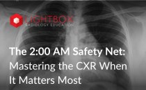 CXR